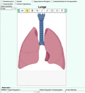 Digitale-Prozessunterstuetzung-Grafische-Lokalisationsangaben-Organschemata